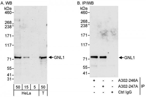 Anti-GNL1