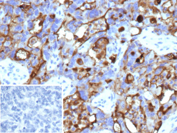 Anti-MUC16 / Ovarian cancer antigen 125, clone CA125/13895R