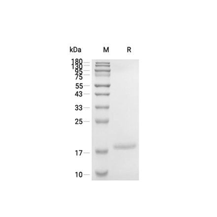 IL-1 beta (Interleukin 1 beta) Recombinant (Human)