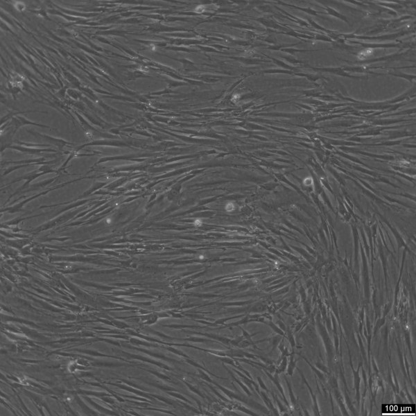 CCD-18Lu Cells