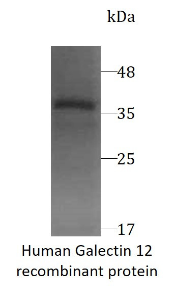 Human Galectin 12 recombinant protein (His-tagged)