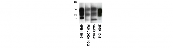 Anti-Prion Protein - Sha31