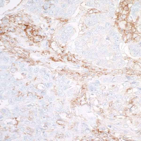 Anti-SIRP alpha Recombinant Monoclonal