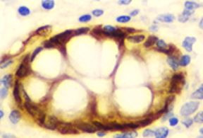 Anti-GIPC2