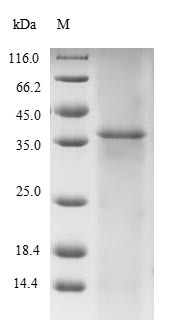 Titin (TTN), partial, human, recombinant