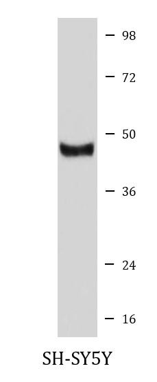 Anti-EGLN1 / PHD2
