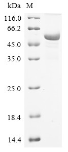 Sodium/potassium-transporting ATPase subunit alpha-1 (Atp1a1), partial, mouse, recombinant