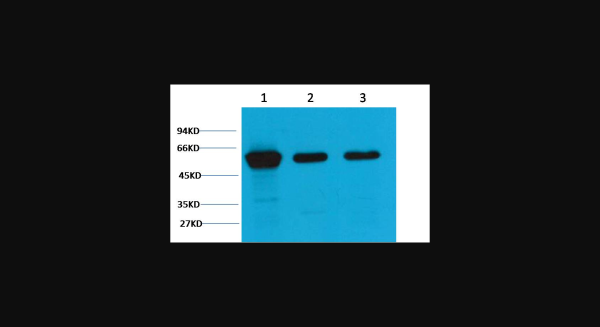 Anti-Vimentin, monoclonal