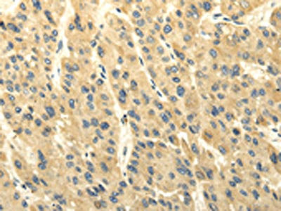 Anti-ABCB7