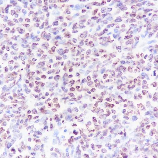 Anti-Recombinant CENP-A, clone A184