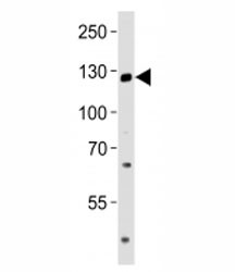 Anti-TRPM8