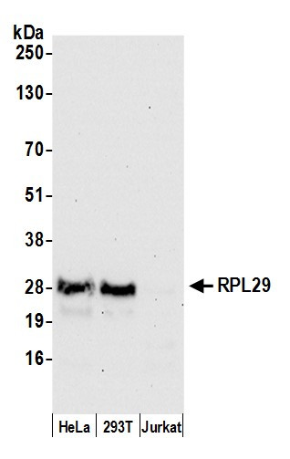 Anti-RPL29/ Ribosomal Protein L29