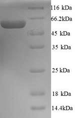 Melanoma antigen preferentially expressed in tumors (PRAME), human, recombinant