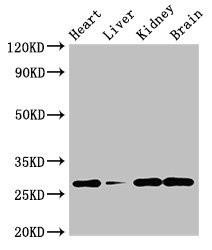 Anti-GUCD1