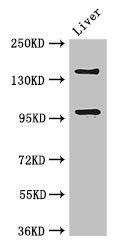 Anti-PHLDB2