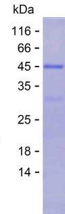 IL6 (human), recombinant protein