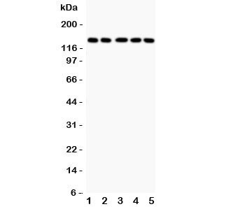 Anti-Collagen Type 2