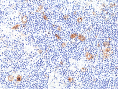 Anti-CD30 (human), Rabbit Monoclonal (RM425)