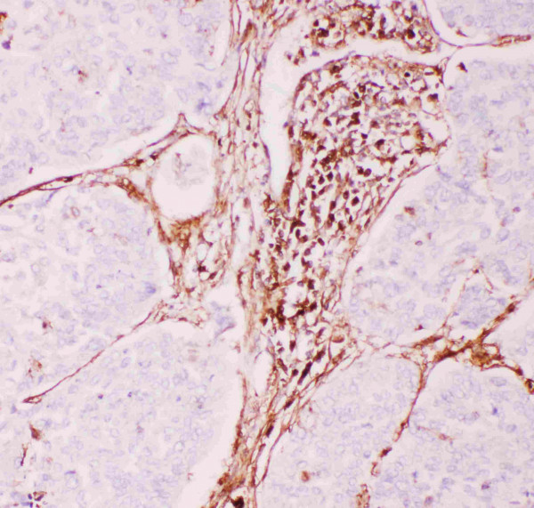 Anti-MDR1 / P Glycoprotein 1
