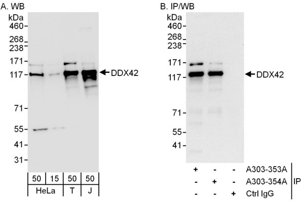Anti-DDX42