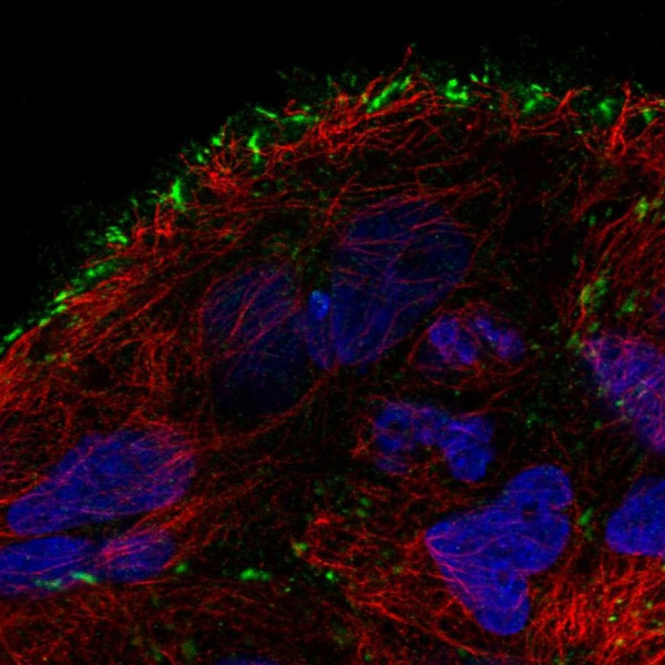 Anti-TMEM52B