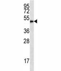 Anti-HDAC3