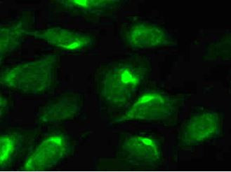 Anti-Stearoyl-CoA desaturase