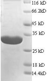 H-2 class II histocompatibility antigen gamma chain (Cd74), partial, mouse, recombinant