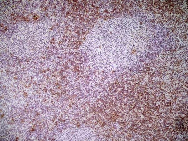 Anti-CD8a, clone KT15