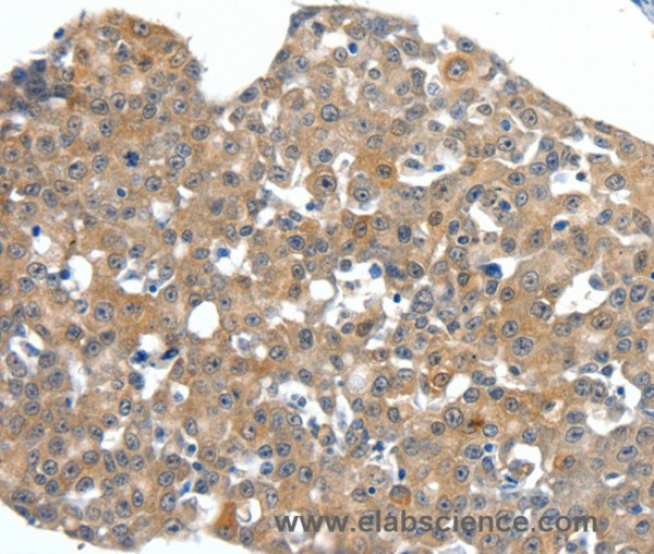 Anti-SCN11A