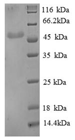 Beta-enolase (ENO3), partial, human, recombinant