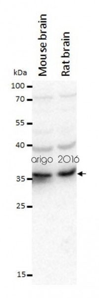 Anti-Caspase-3