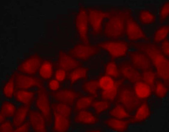 Anti-Cathepsin E