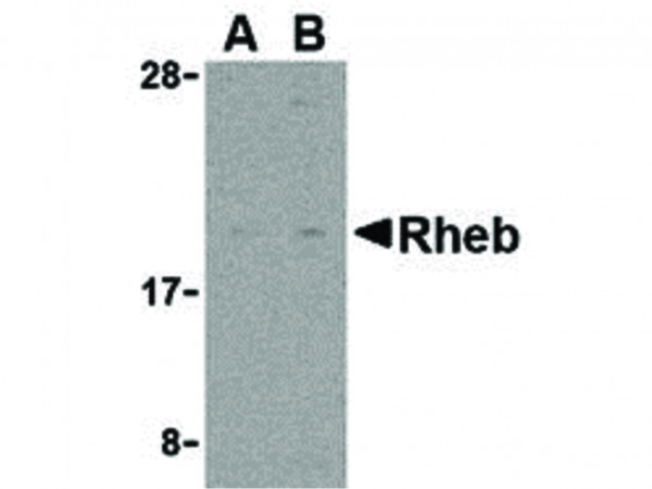 Anti-Rheb