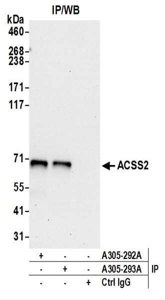 Anti-ACSS2/ACS