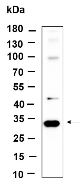 Anti-Recombinant Snail, clone 11A3
