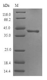 5-Hydroxytryptamine receptor 3D (HTR3D), partial, human, recombinant