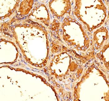 Anti-TG / Thyroglobulin, clone 6E1