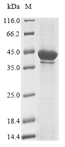 Melanoma-associated antigen 1 (MAGEA1), human, recombinant