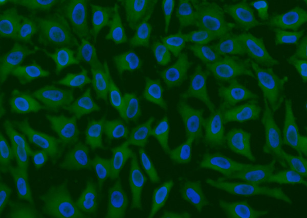 Anti-GPX4 Monoclonal Antibody