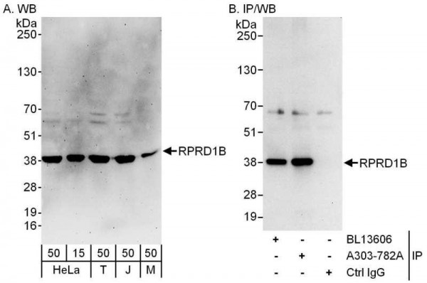 Anti-RPRD1B