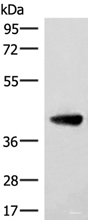 Anti-ST8SIA4
