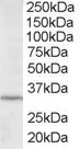 Anti-ING2 / ING1L, C-terminal