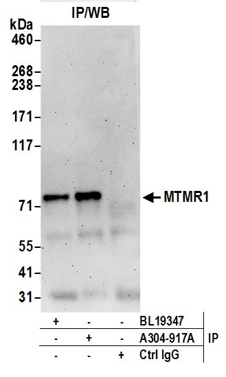 Anti-MTMR1
