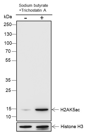 Anti-Recombinant Histone H2A (Acetyl Lys5), clone A109