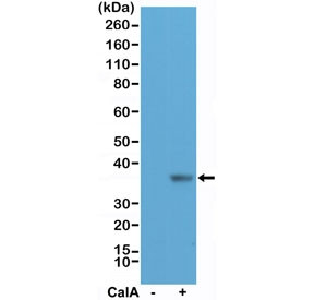 Anti-phospho-EIF2A (pS51) (recombinant antibody), clone RM298