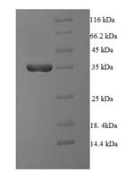 Serine/threonine-protein phosphatase 2A regulatory subunit B'' subunit beta (PPP2R3B), human, recomb