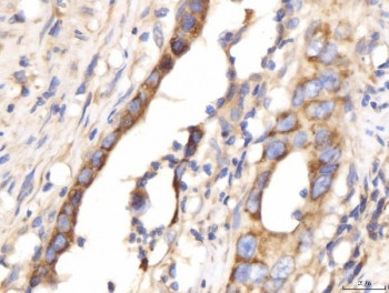 Anti-Myomegalin / PDE4DIP