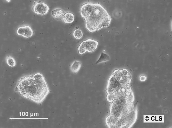 HROC374 Cells