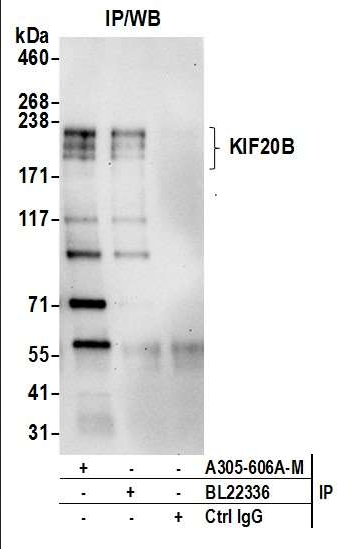 Anti-KIF20B
